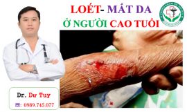 Điều trị lở loét da bằng cao dán Đông y tại Quảng Ninh