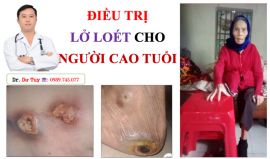 Điều trị lở loét da bằng cao dán Đông y tại Hà Nội