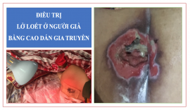 Điều trị vết thương loét da bị hoại tử bằng cao dán Đông y gia truyền tại Lai Châu