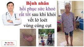 Điều trị vết thương loét da bị hoại tử bằng cao dán Đông y gia truyền tại Thái Nguyên