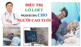 Điều trị lở loét da bằng cao dán Đông y tại Ninh Bình
