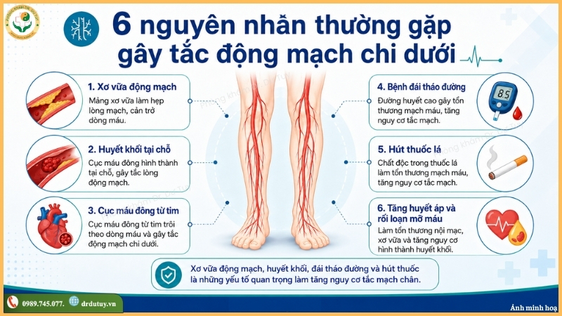 6-nguyen-nhan-gay-tac-dong-mach-chi-duoi