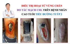 Điều trị hoại tử da cho bệnh nhân bị tiểu đường tại Quảng Ninh