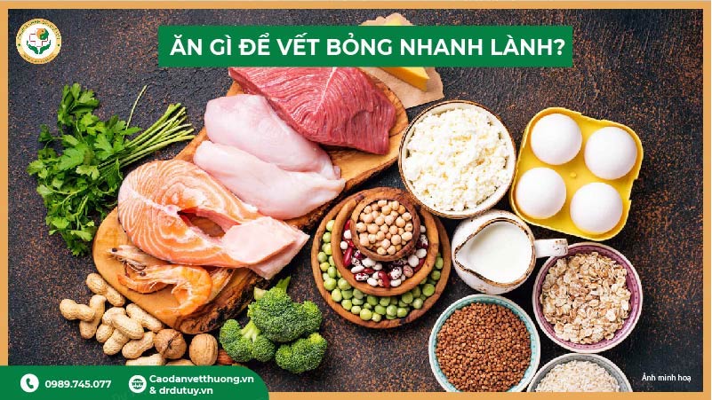 ăn gì để vết bỏng nhanh lành