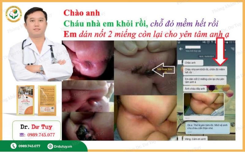 ap-xe-hau-mon-o-tre-so-sinh-7