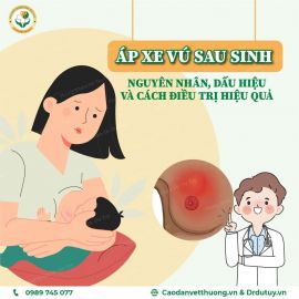 Áp Xe Vú Sau Sinh: Nguyên Nhân, Dấu Hiệu và Cách Điều Trị Hiệu Quả