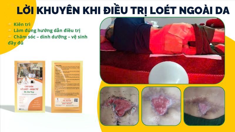 ba-giai-doan-lanh-vet-loet-lon-theo-y-hoc