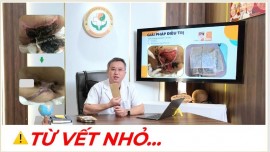 Từ Vết Nhỏ Đến Ổ Loét Nặng: Bài Học Đắt Giá Khi Chăm Sóc Người Cao Tuổi