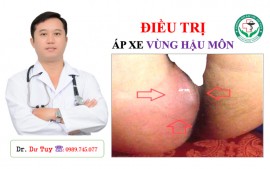 Bác sĩ Tuy chuyên điều trị áp xe hậu môn