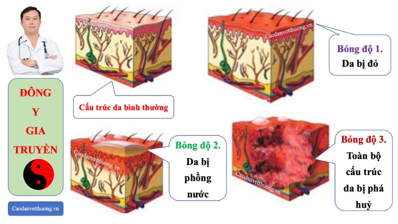 bac-sy-tuy-chuyen-chua-lanh-vet-bong-ngoai-da-tai-nha-bang-cao-dan-gia-truyen4