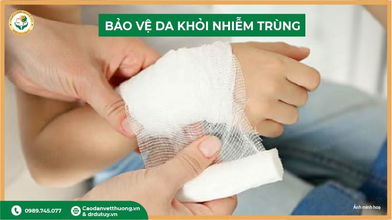 băng gạc bảo vệ vết bỏng