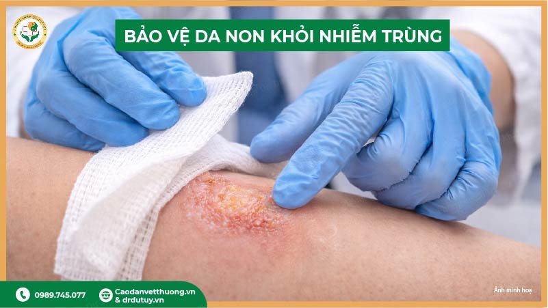 băng vết bỏng bằng gạc