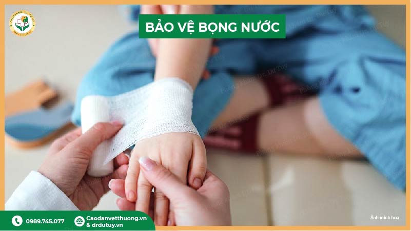 bảo vệ bỏng nước bằng gạc sạch