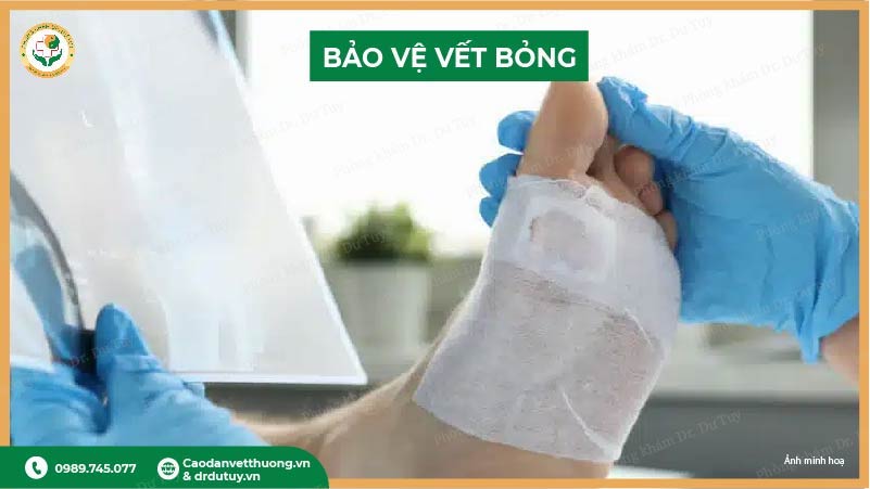 bảo vệ vết bỏng bằng gạc sạch