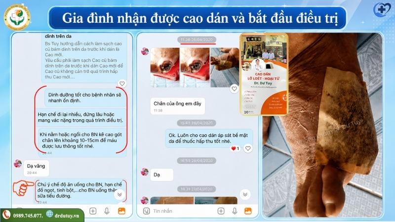 bat-dau-cham-soc-mom-cut-tai-nha