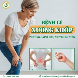 Bệnh Lý Xương Khớp Thường Gặp Ở Phụ Nữ Trung Niên