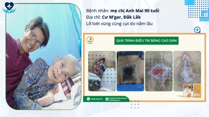 benh-nhan-90-tuoi-loet-ty-de