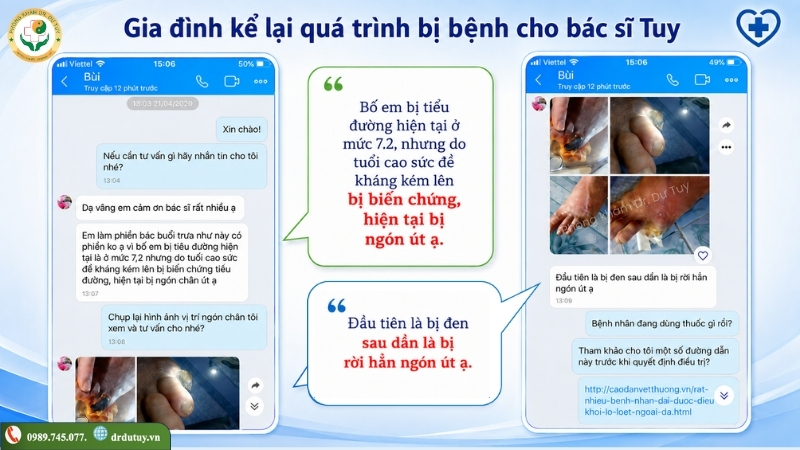 benh-nhan-tieu-duong-mat-ngon-chan-ut