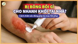 Bị bỏng bôi gì cho nhanh khỏi tại nhà? Cách chăm sóc đúng giúp da mau hồi phục