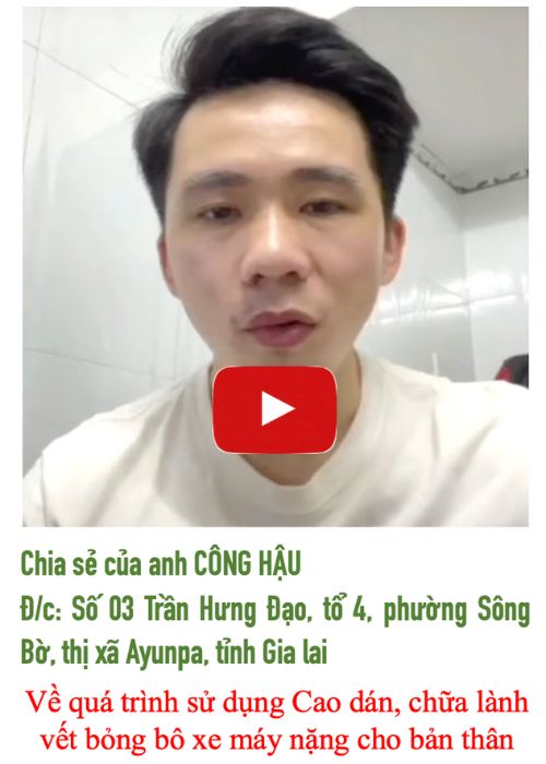 Bỏng bô xe máy nặng