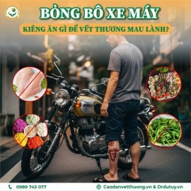 Bỏng bô xe máy nên kiêng gì để vết thương mau lành