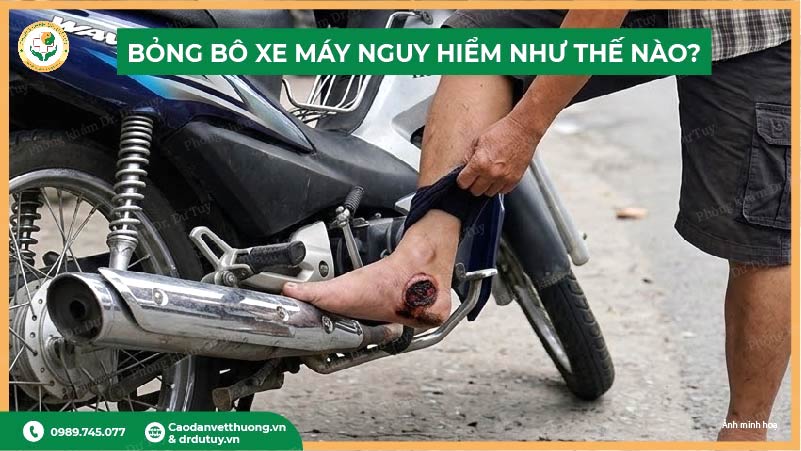 bỏng bô xe máy nguy hiểm như thế nào?