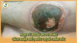 Bỏng Gây Hoại Tử Ngoài Da