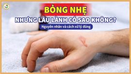 Bỏng nhẹ nhưng lâu lành có sao không? Nguyên nhân và cách xử lý đúng