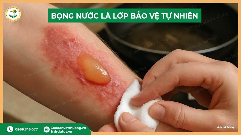 bọng nước là lớp bảo vệ tự nhiên