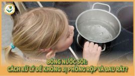 Bỏng nước sôi: Làm sao để không bị phồng rộp và đau rát?