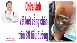 Bs Tuy chữa lành biến chứng lở loét da ở bệnh nhân tiểu đường