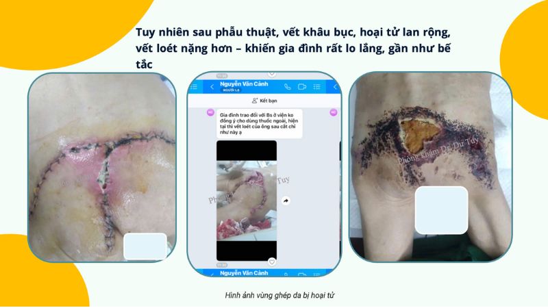 cac-bieu-hien-ghep-da-thanh-cong