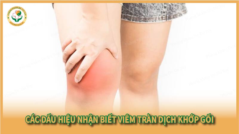 cac-dau-hieu-nhan-biet-viem-tran-dich-khop-goi