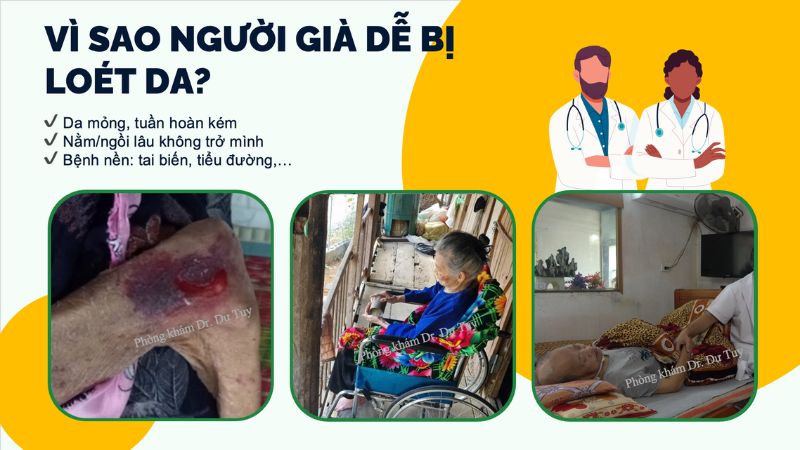 cach-cham-soc-cha-me-tuoi-gia