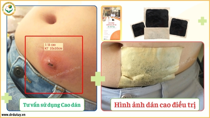 cach-dan-cao-10x10cm-cho-o-ap-xe