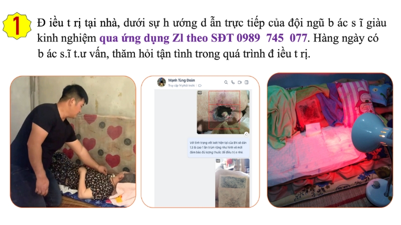 Cách làm vết thương mau khô