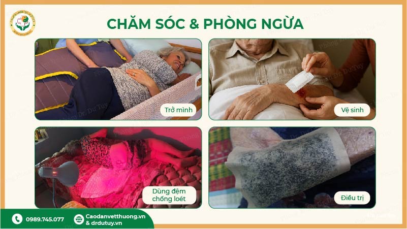 cach-phong-ngua-loet-ti-de-cho-nguoi-nam-lau