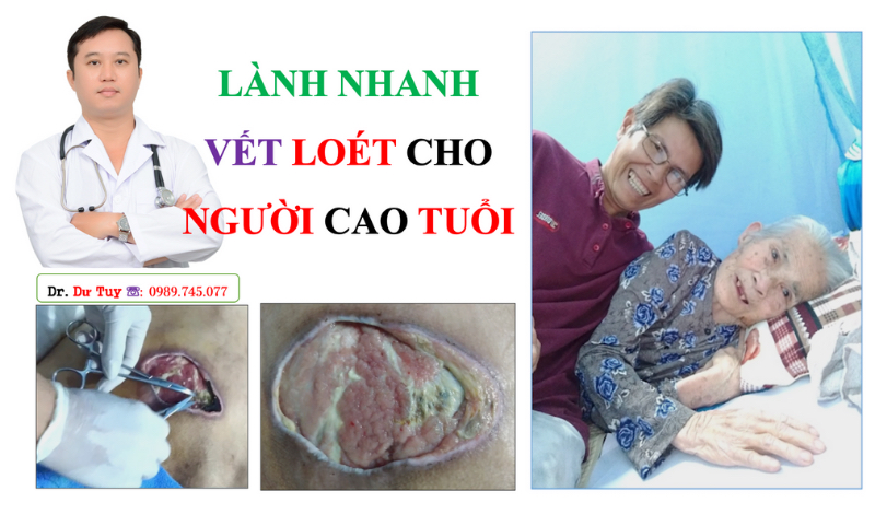 cach-phong-ngua-loet-ti-de