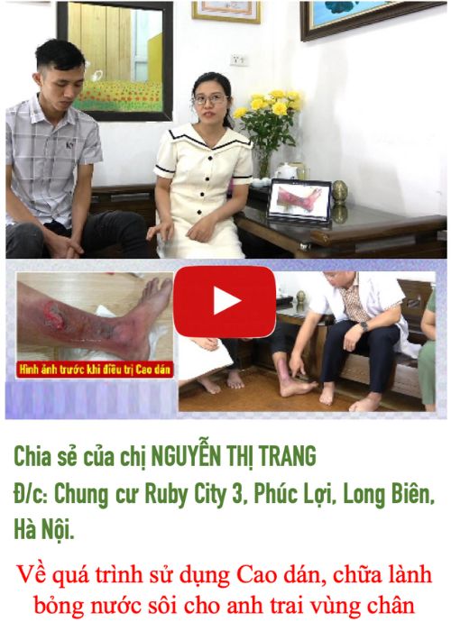 Cách trị bỏng