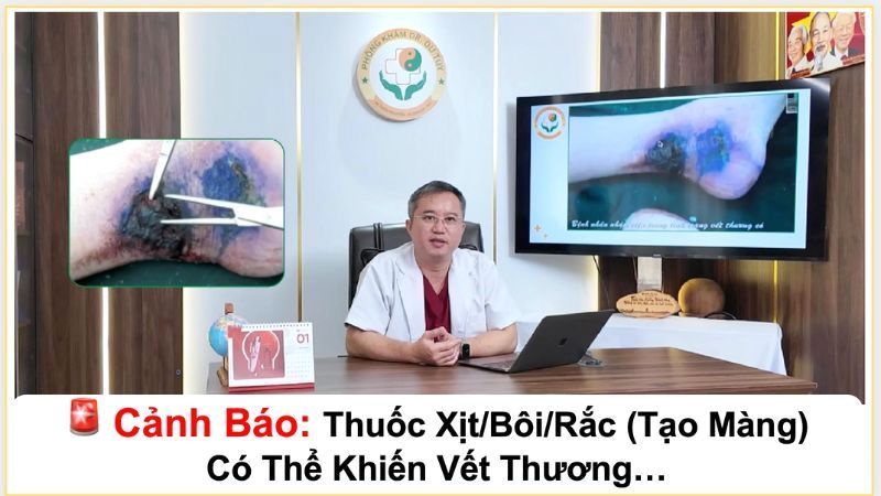 cách trị loét da