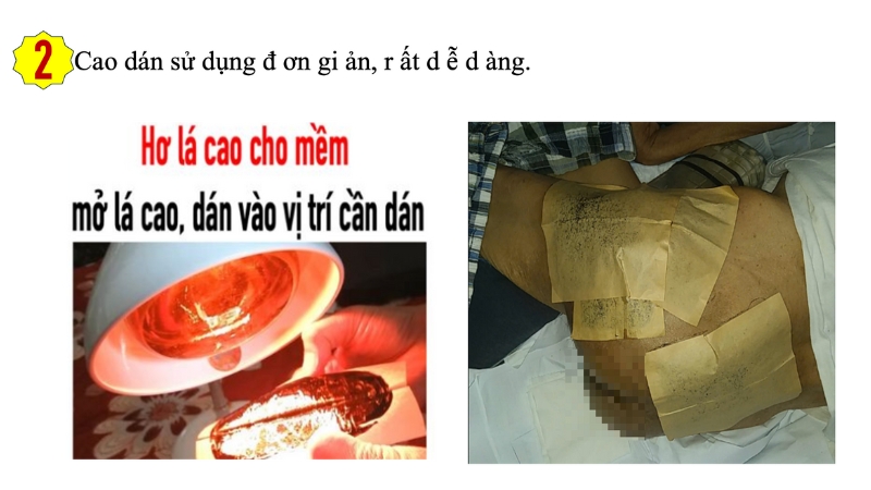 Cách trị loét