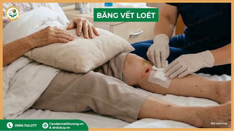 cach-ve-sinh-vet-loet-ti-de-tai-nha-chuan-y-khoa-giup-nhanh-lanh