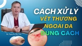 Cách xử lý vết thương ngoài da: Những lưu ý quan trọng để vết thương nhanh lành