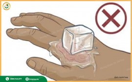 Cảnh báo những sai lầm khi sơ cứu bỏng tại nhà 