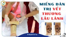 Vết thương cẳng chân hơn 20 ngày chưa lành: Hành trình hồi phục của người phụ nữ ngoài 60 tuổi ở Bát Tràng