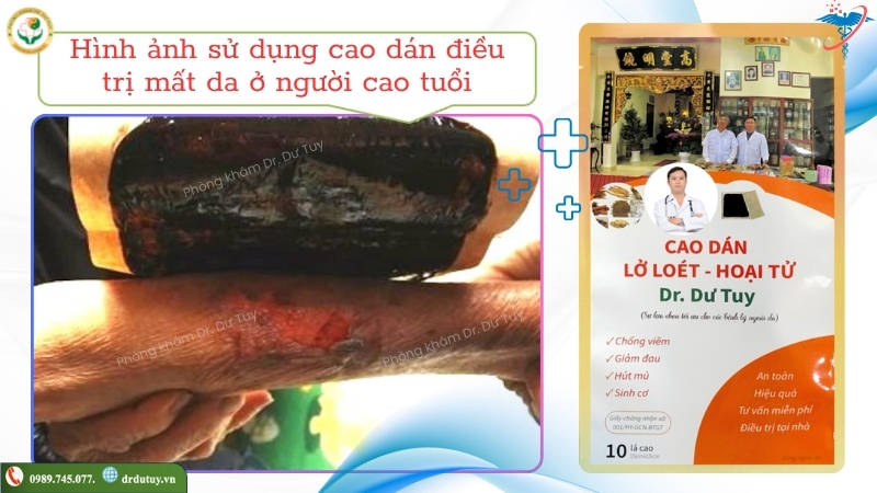 cao-dan-cham-soc-vet-thuong-mat-da