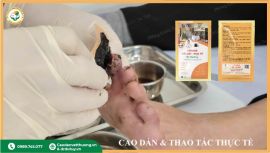 Cao dán thảo dược: Giải pháp thay thế VAC trị lở loét, hoại tử