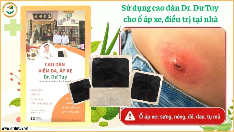 cao-dan-dr-du-tuy-ho-tro-ap-xe-ngoai-da