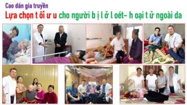 Cao dán gia truyền: Lựa chọn tối ưu cho người bị lở loét- hoại tử ngoài da