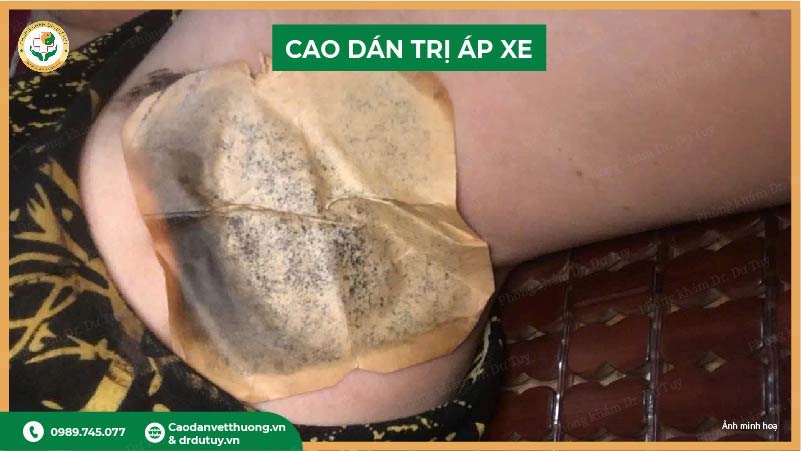 cao-dan-tri-ap-xe